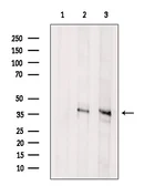 Anti-Asporin antibody used in Western Blot (WB). GTX05211