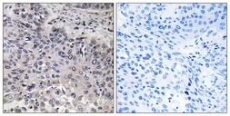 Anti-C1qC antibody used in IHC (Paraffin sections) (IHC-P). GTX05219