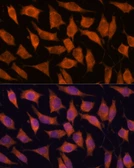 Anti-KIF13A antibody used in Immunocytochemistry/ Immunofluorescence (ICC/IF). GTX05224