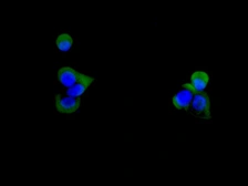 Anti-CD59 antibody [AABE-3] used in Immunocytochemistry/ Immunofluorescence (ICC/IF). GTX05226