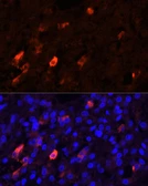 Anti-Proenkephalin antibody used in Immunocytochemistry/ Immunofluorescence (ICC/IF). GTX05231
