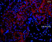 Anti-ST2 antibody used in IHC (Paraffin sections) (IHC-P). GTX05232