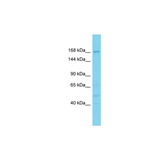 Anti-DDX60L antibody used in Western Blot (WB). GTX05234