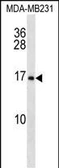 Anti-MAGP1 antibody used in Western Blot (WB). GTX05236