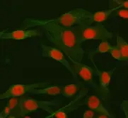 Anti-CtIP antibody used in Immunocytochemistry/ Immunofluorescence (ICC/IF). GTX05240