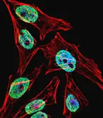 Anti-TERT antibody used in Immunocytochemistry/ Immunofluorescence (ICC/IF). GTX05257