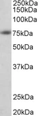 Anti-beta Amyloid (1-16) antibody used in Western Blot (WB). GTX05258