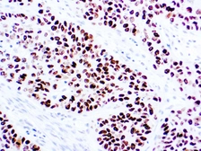 Anti-p40 antibody (ready-to-use) used in IHC (Paraffin sections) (IHC-P). GTX05260