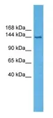 Anti-TRPA1 antibody used in Western Blot (WB). GTX05263