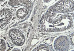 Anti-HOXA10 antibody used in IHC (Paraffin sections) (IHC-P). GTX05266
