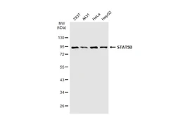 Anti-STAT5B antibody [GT1160] used in Western Blot (WB). GTX08967