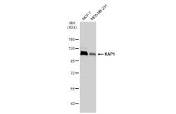 Anti-KAP1 antibody [GT1161] used in Western Blot (WB). GTX08968