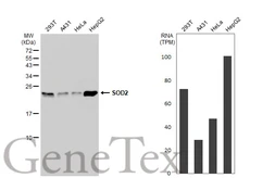 Anti-SOD2 antibody [GT1165] used in Western Blot (WB). GTX09013