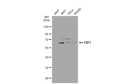 Anti-E2F1 antibody [GT1167] used in Western Blot (WB). GTX09015