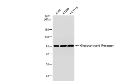 Anti-Glucocorticoid Receptor antibody [GT1170] used in Western Blot (WB). GTX09130