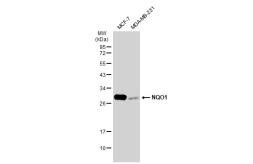 Anti-NQO1 antibody [GT1171] used in Western Blot (WB). GTX09504