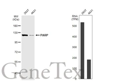 Anti-PARP antibody [GT1176] used in Western Blot (WB). GTX09509