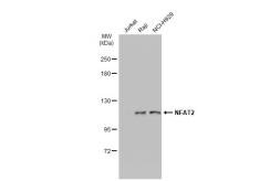 Anti-NFAT2 antibody [GT1177] used in Western Blot (WB). GTX09510