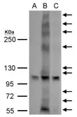 Anti-GPR30 antibody used in Western Blot (WB). GTX100001