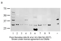 Anti-Melatonin Receptor 1A antibody used in Western Blot (WB). GTX100003