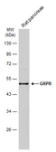 Anti-GRPR antibody [C1C2], Internal used in Western Blot (WB). GTX100015