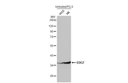 Anti-EDG7 antibody [N3C2], Internal used in Western Blot (WB). GTX100018
