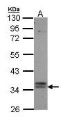 Anti-TGR5 antibody [C2C3], C-term used in Western Blot (WB). GTX100026