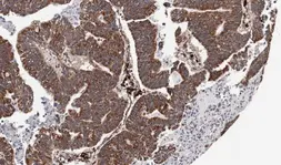 Anti-CXCR7 antibody [C1C2], Internal used in IHC (Paraffin sections) (IHC-P). GTX100027