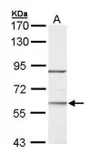 Anti-ROR alpha antibody [N2N3] used in Western Blot (WB). GTX100029