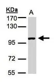 Anti-ABR antibody [C3], C-term used in Western Blot (WB). GTX100031