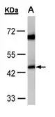 Anti-ACADM antibody used in Western Blot (WB). GTX100032
