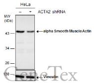 Anti-alpha Smooth Muscle Actin antibody used in Western Blot (WB). GTX100034