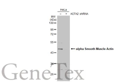 Anti-alpha Smooth Muscle Actin antibody used in Western Blot (WB). GTX100034