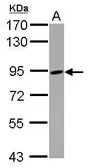 Anti-ADAM8 antibody used in Western Blot (WB). GTX100036