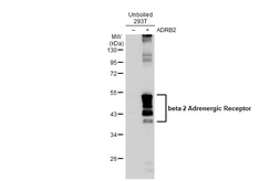 Anti-beta 2 Adrenergic Receptor antibody [C2C3], C-term used in Western Blot (WB). GTX100040