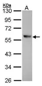 Anti-ALDH1A1 antibody [C3-2], C-term used in Western Blot (WB). GTX100044