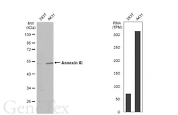 Anti-Annexin XI antibody used in Western Blot (WB). GTX100047