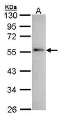 Anti-Annexin XI antibody used in Western Blot (WB). GTX100047
