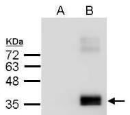 Anti-Apolipoprotein E antibody [C2C3], C-term used in Western Blot (WB). GTX100053