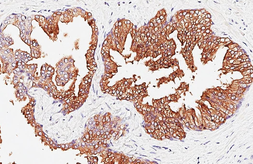 Anti-PSA antibody [C2C3], C-term used in IHC (Paraffin sections) (IHC-P). GTX100054