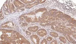 Anti-TRIM23 antibody [N1], N-term used in IHC (Paraffin sections) (IHC-P). GTX100057