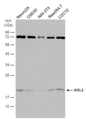 Anti-ARL2 antibody used in Western Blot (WB). GTX100060
