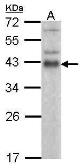 Anti-ATF1 antibody used in Western Blot (WB). GTX100062