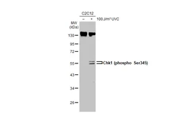 Anti-Chk1 (phospho Ser345) antibody [C1C2], Internal used in Western Blot (WB). GTX100065