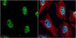 Anti-Chk1 antibody [C1C2-6], Internal used in Immunocytochemistry/ Immunofluorescence (ICC/IF). GTX100070