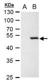 Anti-Chk1 antibody [C1C2-6], Internal used in Western Blot (WB). GTX100070