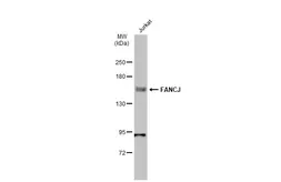 Anti-FANCJ antibody [N1N2], N-term used in Western Blot (WB). GTX100072