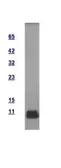 Human GTF2H5 protein, His tag. GTX100076-pro