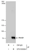 Anti-RecQ1 antibody [N1N2], N-term used in Immunoprecipitation (IP). GTX100084
