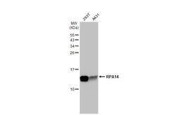 Anti-RPA14 antibody used in Western Blot (WB). GTX100088